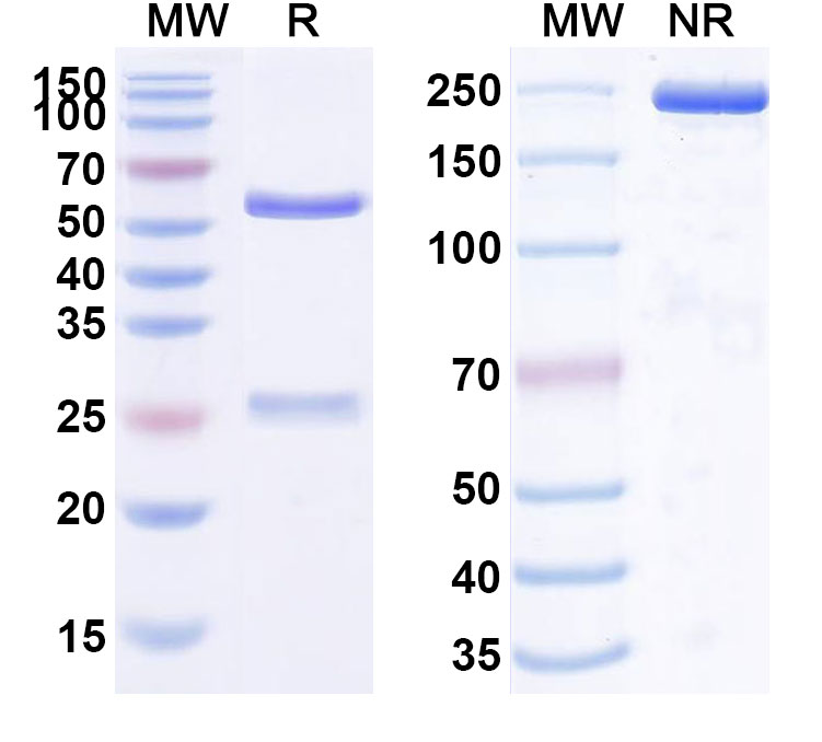 SDS-PAGE for Anti-Human FPN1/SLC40A1/Ferroportin (LY2928057)