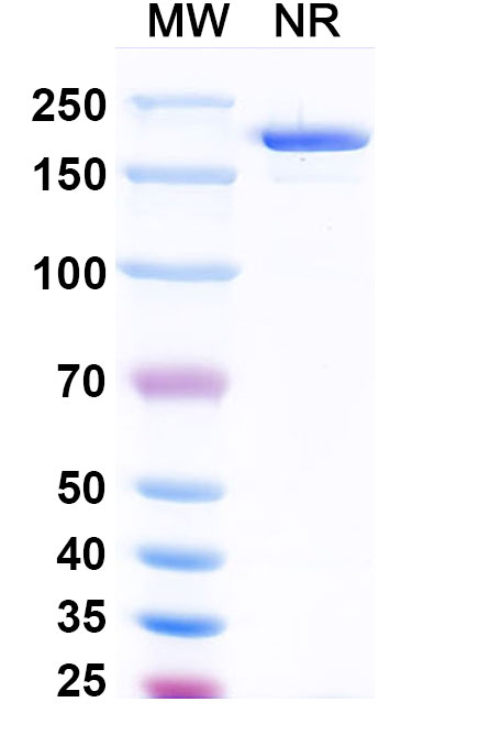 SDS-PAGE for Anti-Human FSHB Antibody (ABS2121)