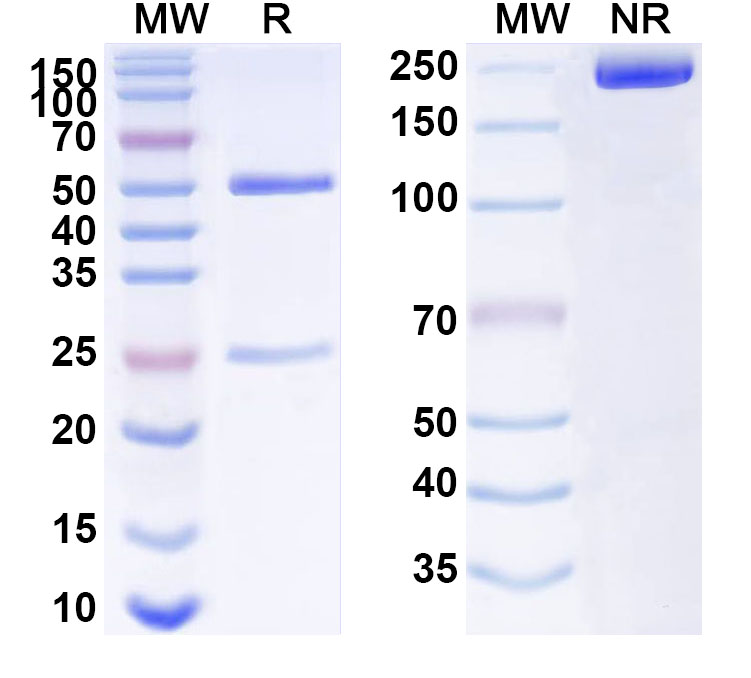 SDS-PAGE for Anti-Human FZD7 Monoclonal Antibody (ABS1592)