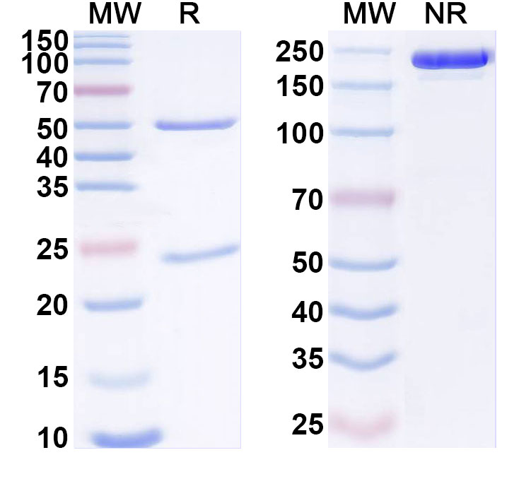 SDS-PAGE for Anti-Human FZD8 Monoclonal Antibody (ABS1576)