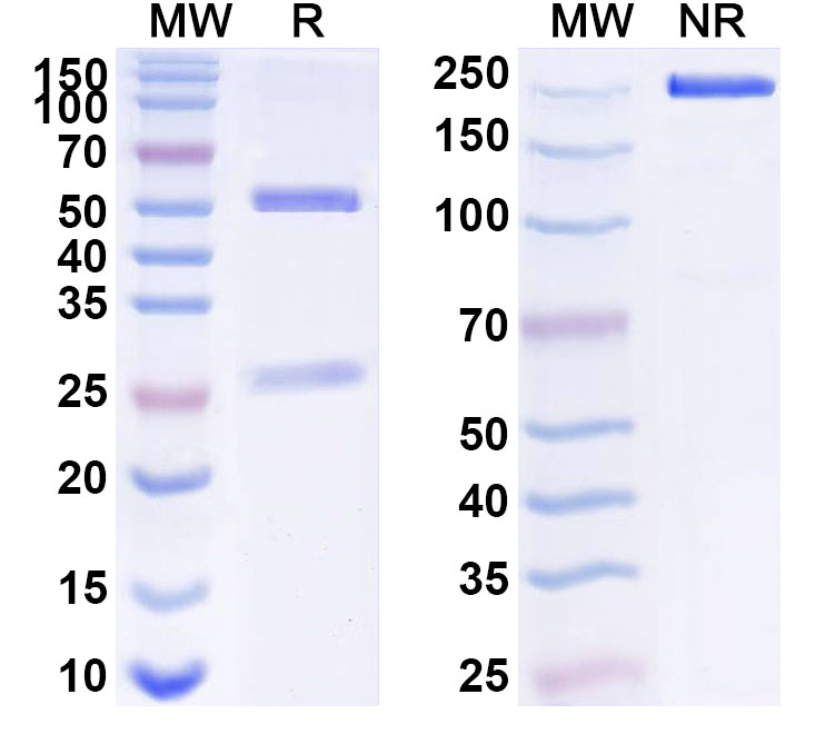 SDS-PAGE for Anti-Human GLUT4/SLC2A4 Antibody (ABS0920)