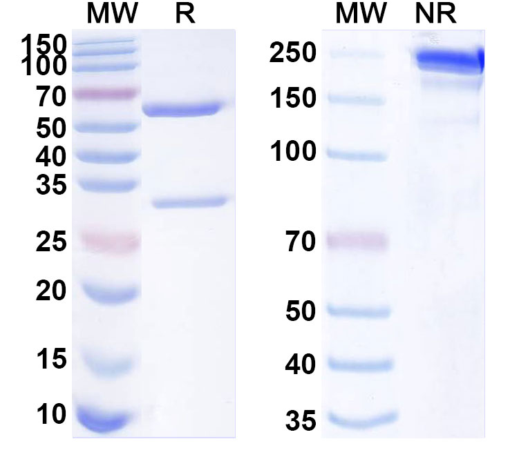 SDS-PAGE for Anti-Human GNLY/Granulysin Antibody (ABS0687)