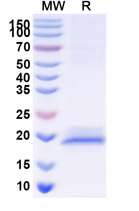 SDS-PAGE for Anti-Human GPC3/Glypican 3 VHH (SAA1340)