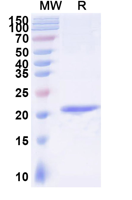 SDS-PAGE for Anti-Human GSN VHH (SAA1011)