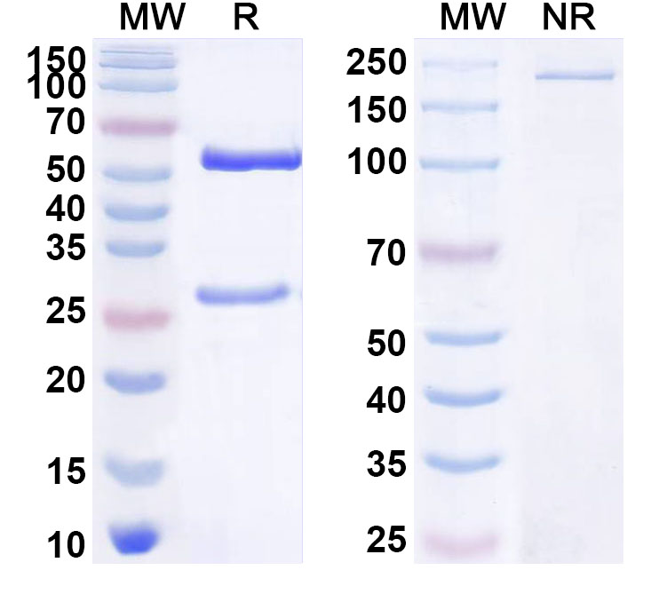 SDS-PAGE for Anti-Human HDGF Antibody (ABS0027)