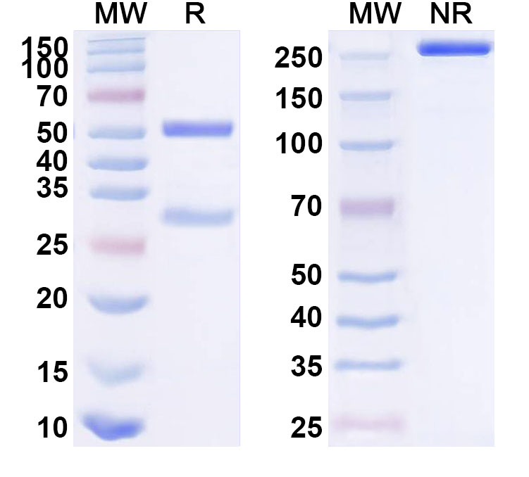SDS-PAGE for Anti-Human IDE Monoclonal Antibody (ABS1778)