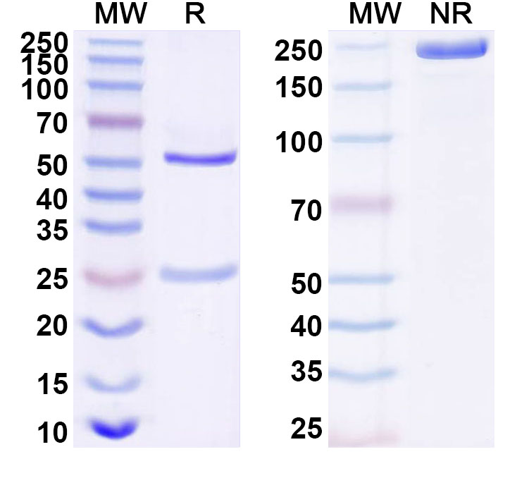 SDS-PAGE for Anti-Human IGSF11 Antibody (ABS0192)
