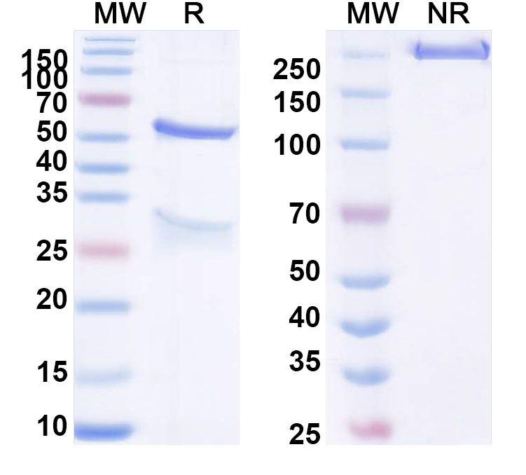 SDS-PAGE for Anti-Human IL18BP Antibody (ABS0813)