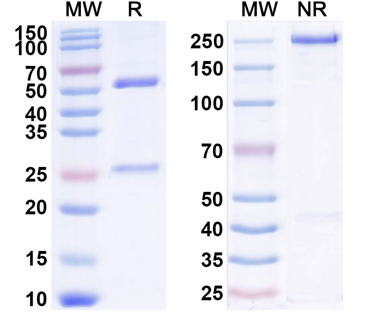 SDS-PAGE for Anti-Human IL2 (AU 007)