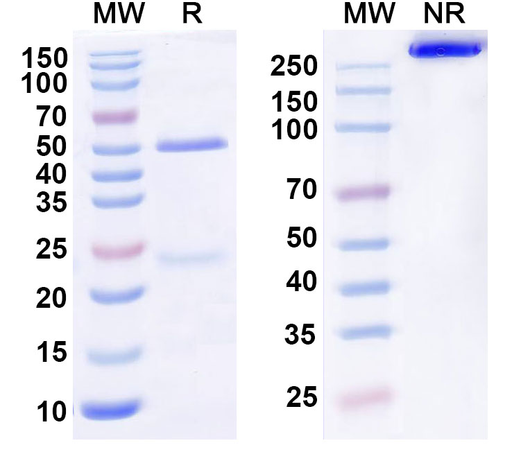 SDS-PAGE for Anti-Human IL31RA Antibody (SAA0825)