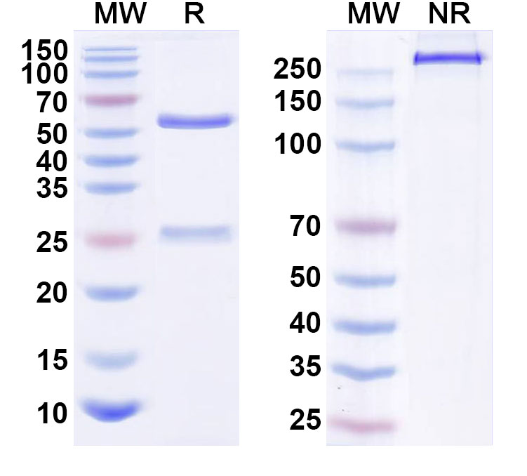 SDS-PAGE for Anti-Human IL38/IL1F10 Antibody (SAA2514)