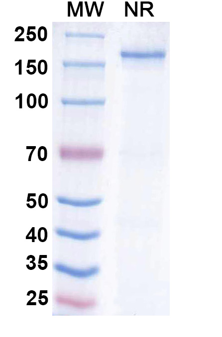 SDS-PAGE for Anti-Human INS/Insulin Antibody (HB125(AE9D6))
