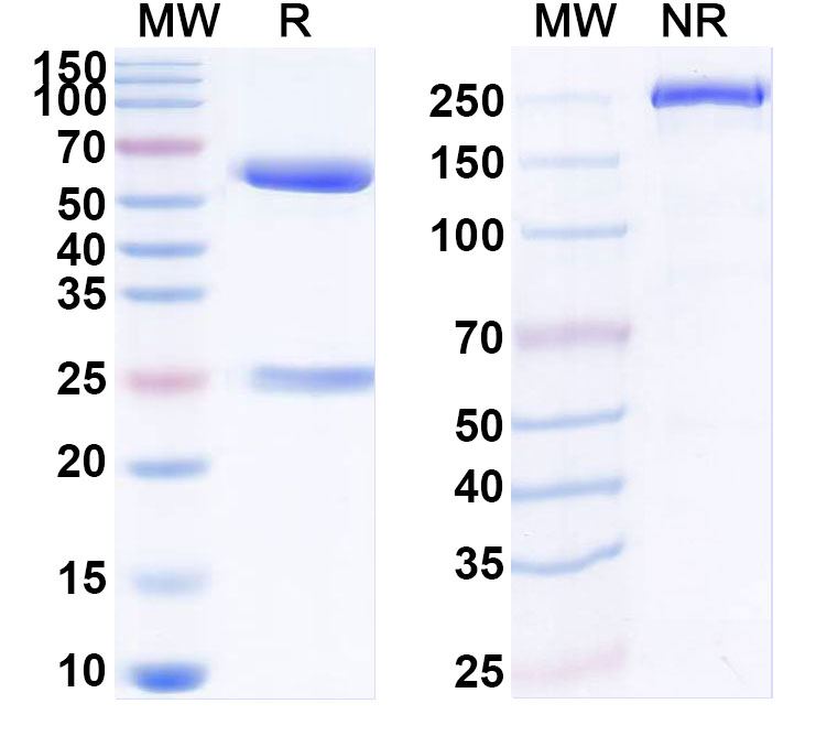 SDS-PAGE for Anti-Human KARS1/Lysyl-tRNA synthetase Antibody (ABS1347)