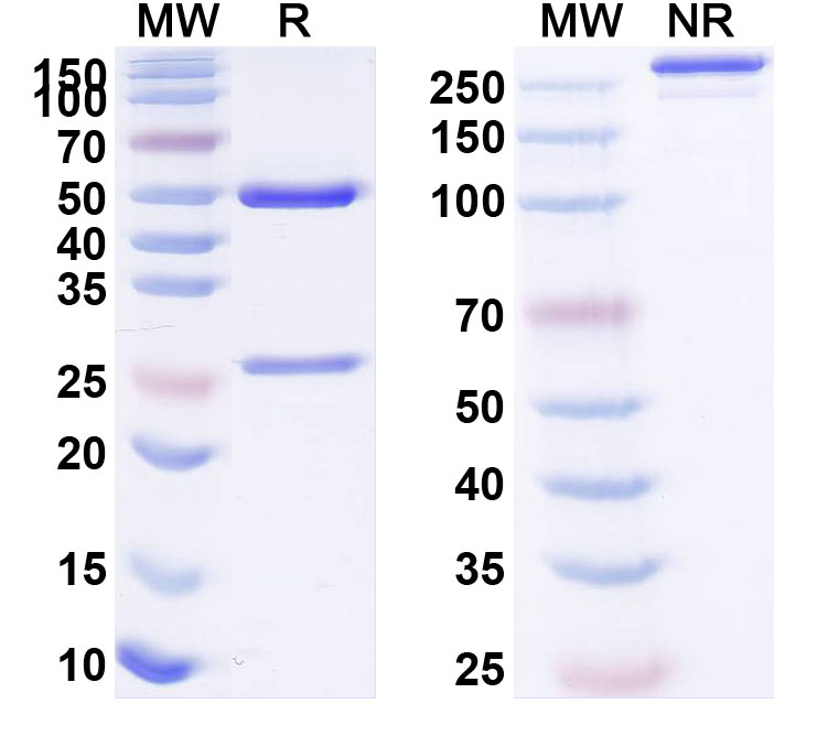 SDS-PAGE for Anti-Human KDM4A IP Antibody (SAA0204)