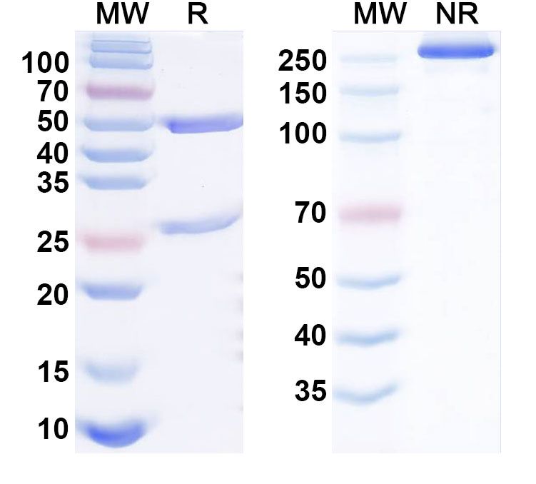 SDS-PAGE for Anti-Human KDM5C IP Antibody (SAA0206)