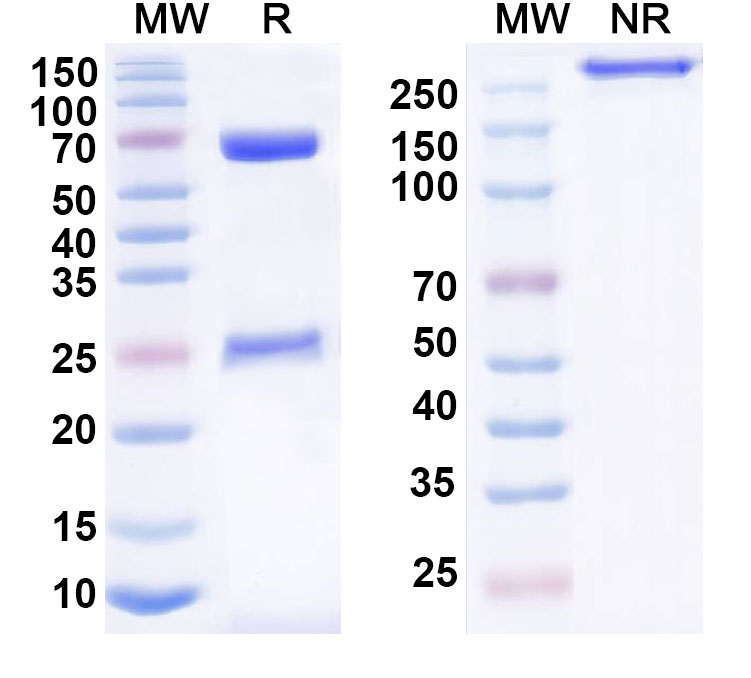 SDS-PAGE for Anti-Human KRT19/CK19 Antibody (SAA0835)