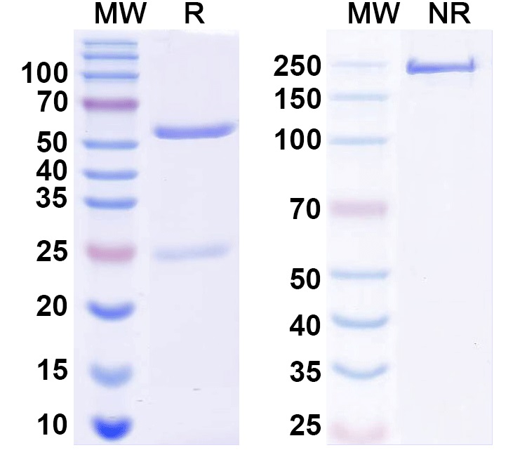 SDS-PAGE for Anti-Human KRT5 Monoclonal Antibody (1A527)