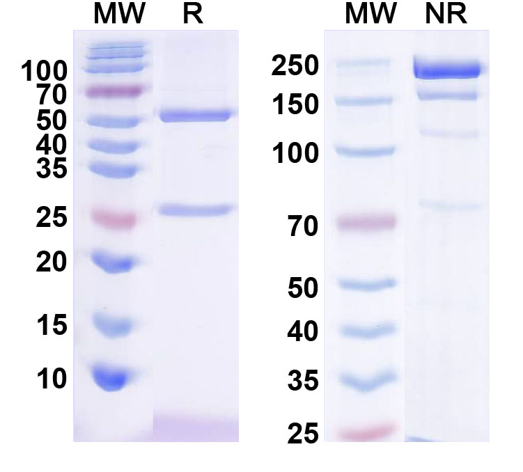 SDS-PAGE for Anti-Human L3MBTL2 IP Antibody (SAA0208)