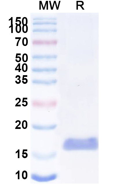 SDS-PAGE for Anti-Human LGR4 VHH&reg; (SAA2294)