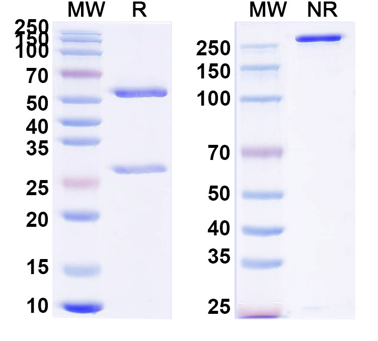SDS-PAGE for Anti-Human LRP5/6 Antibody (SAA0791)