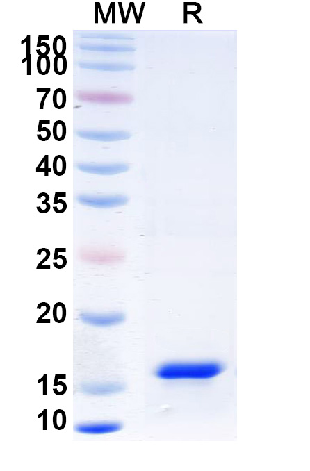 SDS-PAGE for Anti-Human LSP1 VHH (SAA1249)