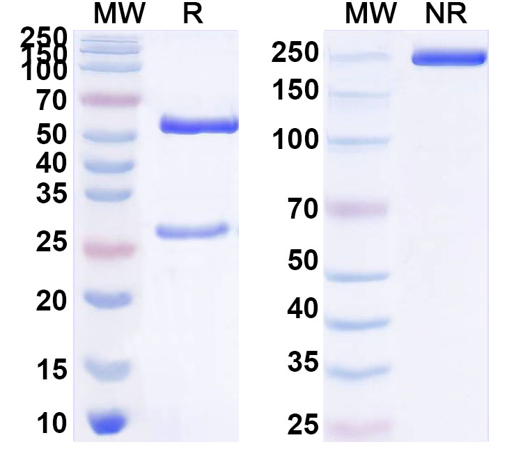 SDS-PAGE for Anti-Human LYPD1 Antibody (ABS1632)