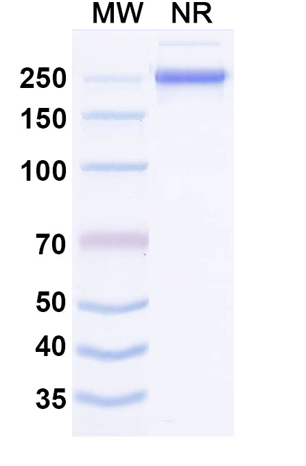 SDS-PAGE for Anti-Human MASP1 Antibody (ABS0569)