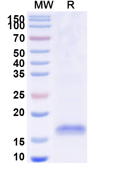 SDS-PAGE for Anti-Human MC4R VHH (SAA1276)