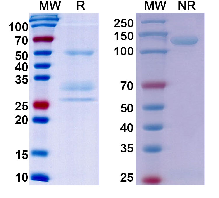 SDS-PAGE for Anti-Human MET/c-Met/HGFR Monoclonal Antibody, SAA0765