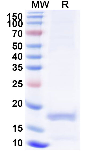 SDS-PAGE for Anti-Human MLPH VHH (SAA1233)