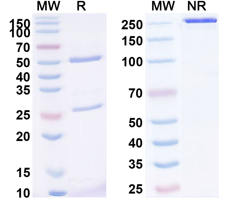 SDS-PAGE for Anti-Human MMP14 (KD014)
