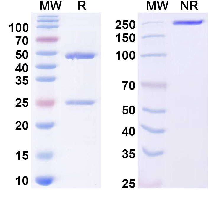 SDS-PAGE for Anti-Human MMP7 Antibody (SAA0353)