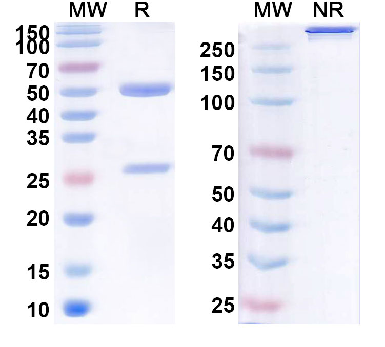 SDS-PAGE for Anti-Human MTF2 IP Antibody (SAA0253)