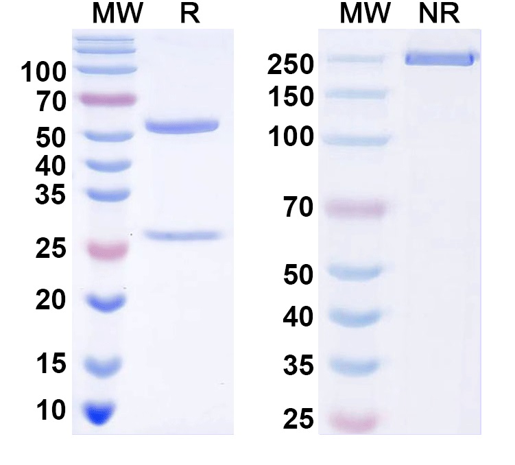 SDS-PAGE for Anti-Human MYOM3/Myomesin-3 Monoclonal Antibody (1A132)