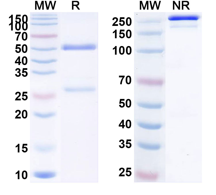 SDS-PAGE for Anti-Human NEU3/Sialidase-3 Antibody (1A038)