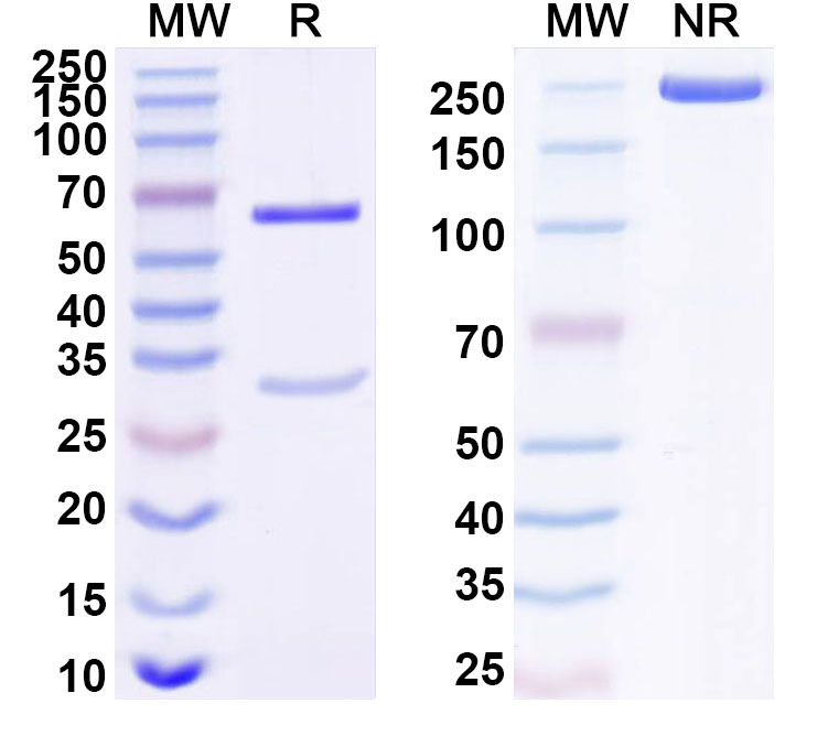 SDS-PAGE for Anti-Human NFKBIB Antibody (ABS1384)