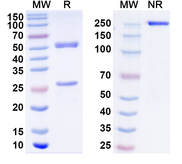 SDS-PAGE for Anti-Human NSD3/WHSC1L1 IP Antibody (SAA0250)