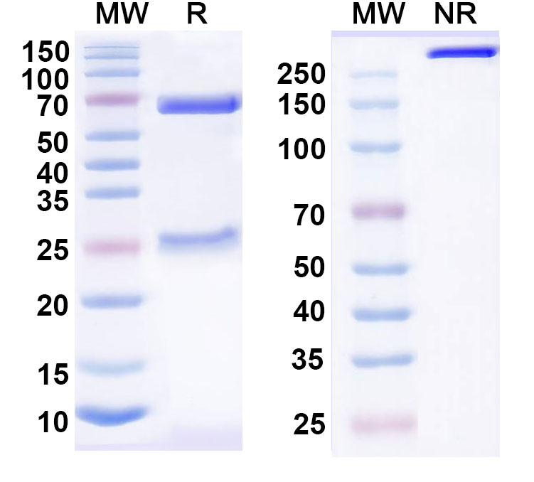 SDS-PAGE for Anti-Human P2RX4 Antibody (SAA0867)