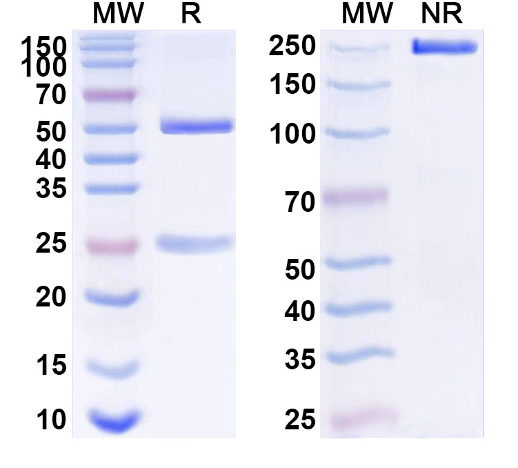SDS-PAGE for Anti-Human PGLYRP1 Antibody (ABS1314)