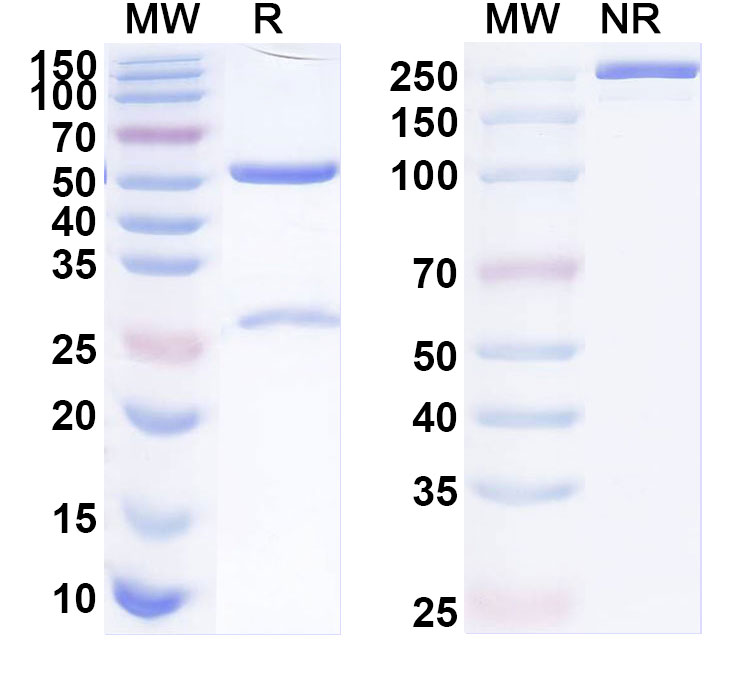 SDS-PAGE for Anti-Human PLAGL1 Antibody (ABS0848)