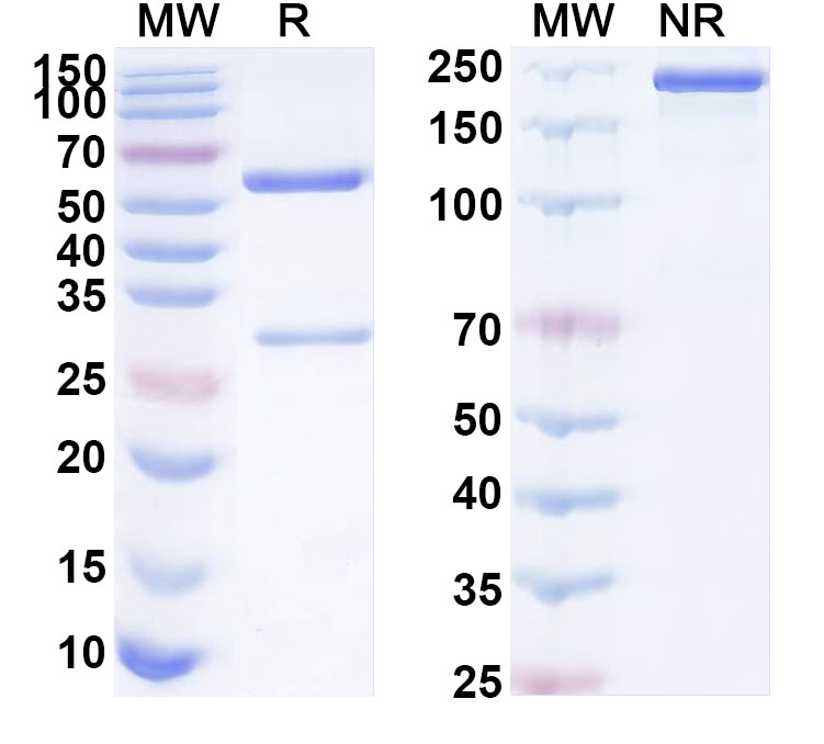 SDS-PAGE for Anti-Human PLXDC2 Antibody (ABS0285)