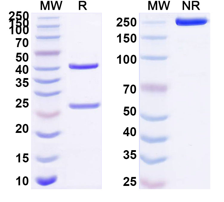 SDS-PAGE for Anti-Human PLXNB1 Antibody (ABS0482)