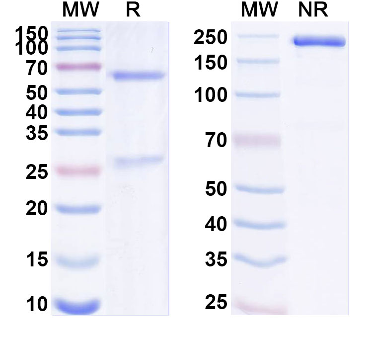 SDS-PAGE for Anti-Human PRAP1/uPA Antibody (ABS1939)
