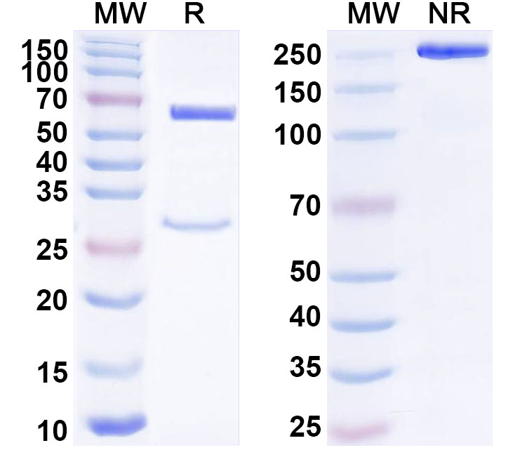 SDS-PAGE for Anti-Human PTGER4/EP4 Receptor Monoclonal Antibody (ABS1746)