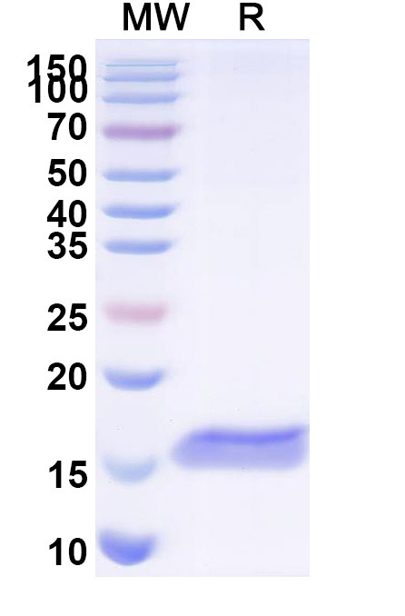 SDS-PAGE for Anti-Human PTH1R VHH (SAA1275)