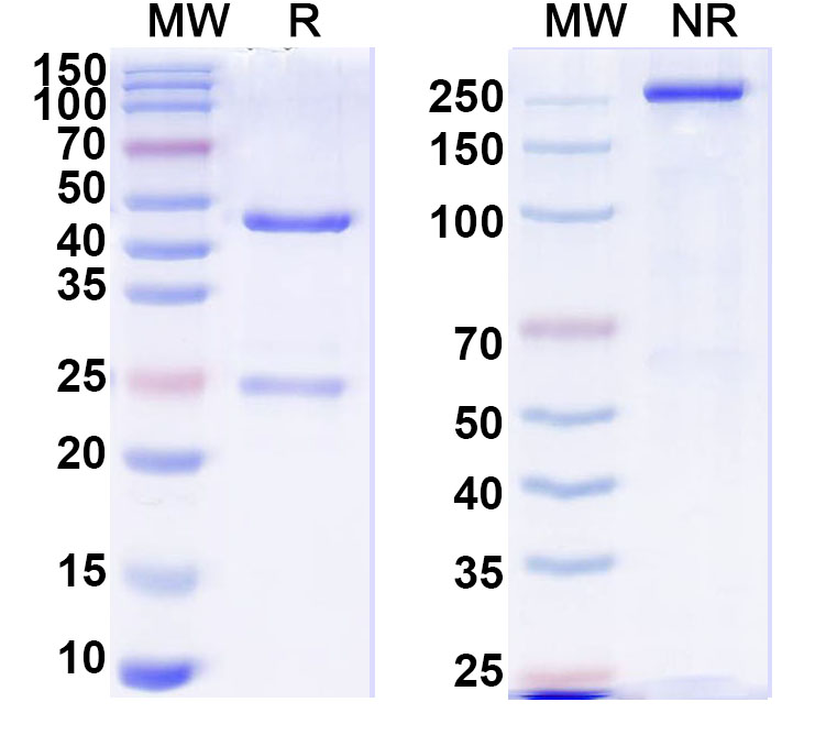 SDS-PAGE for Anti-Human RBBP5 IP Antibody (SAA0256)