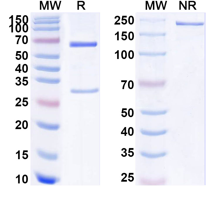 SDS-PAGE for Anti-Human RNLS/Renalase Antibody (ABS1857)