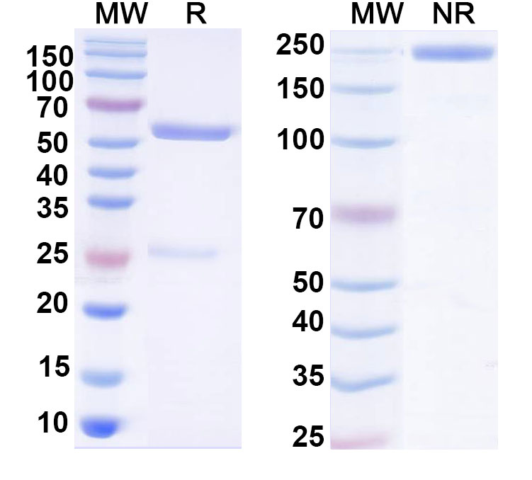 SDS-PAGE for Anti-Human RPRD1A IP Monoclonal Antibody, SAA0248