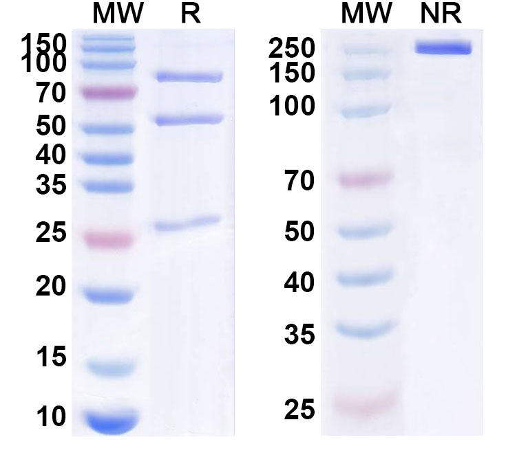 SDS-PAGE for Anti-Human RYK Monoclonal Antibody (ABS1327)