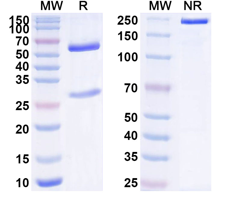 SDS-PAGE for Anti-Human S100A8 Antibody (ABS1011)